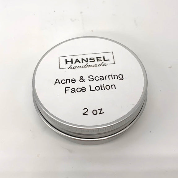 Acne and Scaring Face Lotion