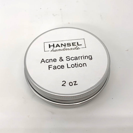Acne and Scaring Face Lotion